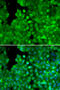 Interleukin 10 Receptor Subunit Alpha antibody, 18-334, ProSci, Immunofluorescence image 