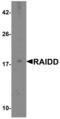 CASP2 And RIPK1 Domain Containing Adaptor With Death Domain antibody, GTX28425, GeneTex, Western Blot image 