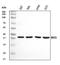 Ribosomal Protein Lateral Stalk Subunit P0 antibody, A04349-1, Boster Biological Technology, Western Blot image 