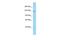 Photoreceptor Cilium Actin Regulator antibody, PA5-70760, Invitrogen Antibodies, Western Blot image 