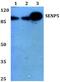 SUMO Specific Peptidase 5 antibody, PA5-75185, Invitrogen Antibodies, Western Blot image 