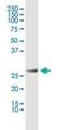 Prohibitin antibody, H00005245-M01, Novus Biologicals, Western Blot image 
