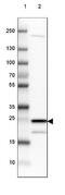 TPD52 Like 1 antibody, NBP1-84313, Novus Biologicals, Western Blot image 
