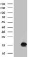 Fragile Histidine Triad Diadenosine Triphosphatase antibody, TA811441S, Origene, Western Blot image 