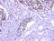 Exocyst Complex Component 1 antibody, NBP2-20281, Novus Biologicals, Immunohistochemistry paraffin image 