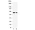 Cyclin Dependent Kinase Inhibitor 1C antibody, R30976, NSJ Bioreagents, Western Blot image 