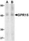 G Protein-Coupled Receptor 15 antibody, TA305992, Origene, Western Blot image 