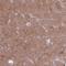 Phosphodiesterase 10A antibody, NBP2-48869, Novus Biologicals, Immunohistochemistry paraffin image 