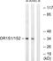 Olfactory Receptor Family 1 Subfamily S Member 2 antibody, GTX87935, GeneTex, Western Blot image 