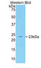 ALOX5 antibody, LS-C292932, Lifespan Biosciences, Western Blot image 