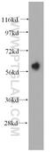 Keratin 6B antibody, 17391-1-AP, Proteintech Group, Western Blot image 