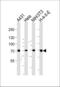 Heat Shock Protein Family A (Hsp70) Member 8 antibody, MBS9200945, MyBioSource, Western Blot image 