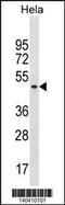 Splicing Factor 3b Subunit 4 antibody, 60-518, ProSci, Western Blot image 