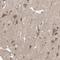 ArfGAP With Dual PH Domains 1 antibody, NBP1-88097, Novus Biologicals, Immunohistochemistry frozen image 