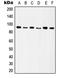 Integrin Subunit Beta 5 antibody, LS-C352389, Lifespan Biosciences, Western Blot image 