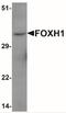 Forkhead Box H1 antibody, NBP2-41196, Novus Biologicals, Western Blot image 