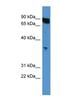 Olfactory Receptor Family 2 Subfamily K Member 2 antibody, NBP1-68965, Novus Biologicals, Western Blot image 