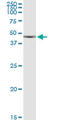 Cyclin Dependent Kinase Like 1 antibody, LS-B6188, Lifespan Biosciences, Western Blot image 