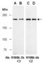 Tet Methylcytosine Dioxygenase 2 antibody, R1086-6b, Abiocode, Western Blot image 