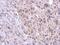 Tetratricopeptide Repeat Domain 39B antibody, GTX125938, GeneTex, Immunohistochemistry paraffin image 