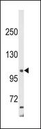 Adaptor Related Protein Complex 2 Subunit Alpha 2 antibody, PA5-35339, Invitrogen Antibodies, Western Blot image 