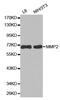 Matrix Metallopeptidase 2 antibody, abx123423, Abbexa, Western Blot image 