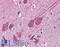 Signal Transducing Adaptor Family Member 2 antibody, LS-B4920, Lifespan Biosciences, Immunohistochemistry paraffin image 