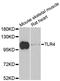 Toll Like Receptor 4 antibody, abx126710, Abbexa, Western Blot image 