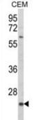 Killer Cell Lectin Like Receptor C2 antibody, abx034036, Abbexa, Immunohistochemistry frozen image 