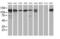 Histone Deacetylase 6 antibody, MA5-25359, Invitrogen Antibodies, Western Blot image 