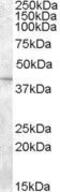 Solute Carrier Family 24 Member 5 antibody, GTX89312, GeneTex, Western Blot image 