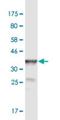 Pogo Transposable Element Derived With KRAB Domain antibody, H00057645-M02, Novus Biologicals, Western Blot image 