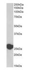 Triosephosphate Isomerase 1 antibody, orb389379, Biorbyt, Western Blot image 