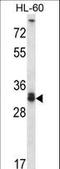 Syntaxin 6 antibody, LS-C161593, Lifespan Biosciences, Western Blot image 