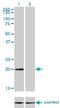Mlp antibody, H00008048-M03, Novus Biologicals, Western Blot image 