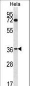 Nucleoporin 35 antibody, LS-C163071, Lifespan Biosciences, Western Blot image 