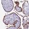 Coiled-Coil And C2 Domain Containing 2A antibody, NBP1-93673, Novus Biologicals, Immunohistochemistry paraffin image 