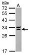 Syndecan Binding Protein 2 antibody, GTX117949, GeneTex, Western Blot image 