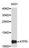 ATP Synthase Membrane Subunit E antibody, STJ26468, St John