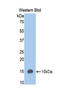 Serpin Family G Member 1 antibody, LS-C303977, Lifespan Biosciences, Western Blot image 