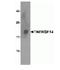 TNF Receptor Superfamily Member 14 antibody, NBP1-76690, Novus Biologicals, Western Blot image 