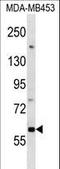 Death Associated Protein Kinase 1 antibody, LS-C164359, Lifespan Biosciences, Western Blot image 