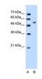 Perilipin 1 antibody, orb324980, Biorbyt, Western Blot image 