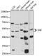 SH2 Domain Containing Adaptor Protein B antibody, 15-987, ProSci, Western Blot image 