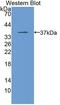 Monoglyceride Lipase antibody, LS-C687764, Lifespan Biosciences, Western Blot image 