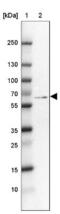 PARP2 antibody, NBP2-47337, Novus Biologicals, Western Blot image 