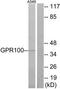 Relaxin Family Peptide/INSL5 Receptor 4 antibody, TA316345, Origene, Western Blot image 