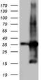 Transforming Acidic Coiled-Coil Containing Protein 2 antibody, CF804146, Origene, Western Blot image 