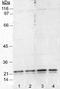 Caveolin 1 antibody, NB100-615, Novus Biologicals, Western Blot image 