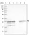 Proteasome Subunit Alpha 5 antibody, NBP1-86838, Novus Biologicals, Western Blot image 